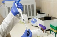 На Днепропетровщине за сутки выявили 2489 новых случаев коронавируса
