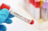 За последние сутки в регионе диагностировали 2420 новых случаев COVID-19