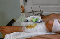Як у лікарнях Дніпра рятують поранених унаслідок бойових дій