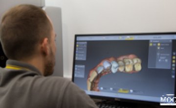 Новый зуб за несколько часов: в Днепре специалисты Medical Dental Group запустили уникальную технологию зубного протезирования