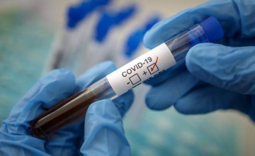 В Днепропетровской области сегодня зарегистрировано 334 новых случая коронавируса, из них 258 - в Днепре