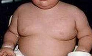 Избыточный вес детей обусловлен генами