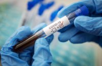 На Днепропетровщине обнаружили 926 новых случаев коронавируса