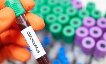 На Днепропетровщине обнаружили 12 новых случаев коронавируса