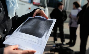 Почти 20 тысяч жителей Днепропетровщины обследуют в передвижных флюорографах