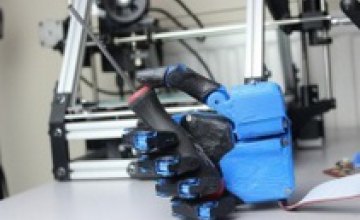 В Украине создадут уникальный протез робото-руки для искалеченных бойцов из зоны АТО