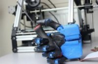 В Украине создадут уникальный протез робото-руки для искалеченных бойцов из зоны АТО