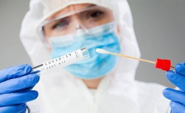 На Днепропетровщине еще 626 человек заразились коронавирусом