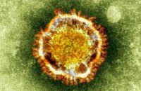 В Украине случаев заболевания коронавирусом пока не выявлено, - эксперт