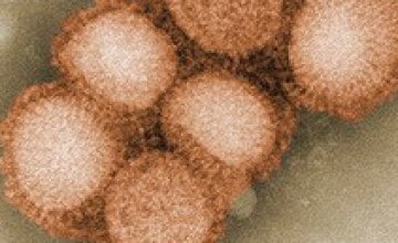 В Днепропетровской области подтверждены 20 случаев заболевания «свиным» гриппом