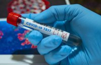Украина находится на 11-м месте в мировом антирейтинге по распространению коронавируса
