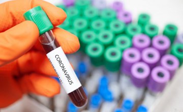 За сутки на Днепропетровщине выявили 8 новых случаев коронавируса