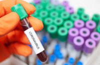 За сутки на Днепропетровщине выявили 8 новых случаев коронавируса