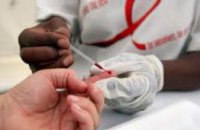 В Днепропетровске можно будет бесплатно пройти тест на ВИЧ