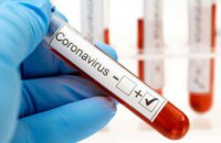 За сутки на Днепропетровщине выявили 781 новый случай COVID-19