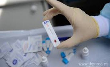В Днепре можно бесплатно пройти экспресс-тест на ВИЧ