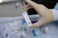 В Днепре можно бесплатно пройти экспресс-тест на ВИЧ