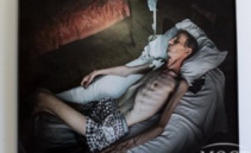 В Кривом Роге заболеваемость туберкулезом снизилась почти на 8%