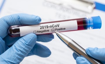 ​Ще 1083 випадки коронавірусу зафіксували на Дніпропетровщині