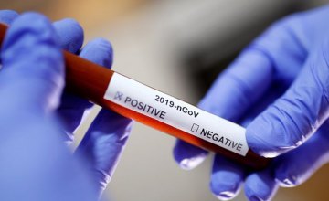 За добу на Дніпропетровщині виявили 34 нові випадки коронавірусу 