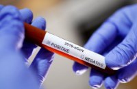 За добу на Дніпропетровщині виявили 34 нові випадки коронавірусу 