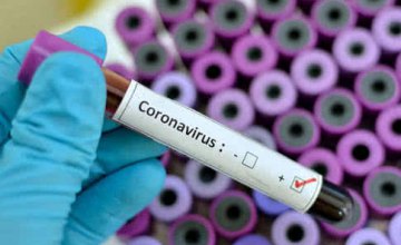 Обновленные данные по коронавирусу в Днепре