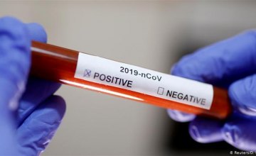 На Днепропетровщине обнаружили 296 новых случаев коронавируса