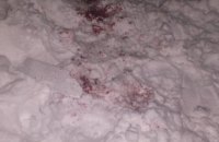 В Харькове из-за фейерверка мужчине оторвало кисть руки