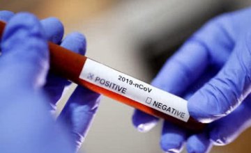 В Украине за сутки зафиксировано 800 новых случаев заражения коронавирусом