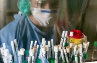 На Днепропетровщине за сутки 279 новых случаев коронавируса