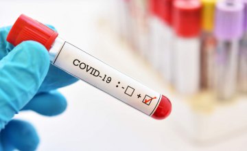 В Украине снова выросло число COVID-заболевших