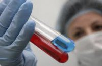 На Днепропетровщине зарегистрировано почти 27 тыс ВИЧ-инфицированных