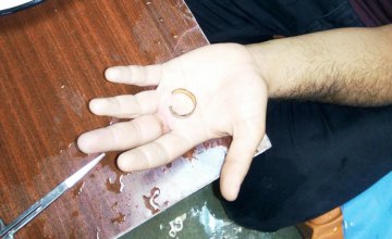 В Днепре спасатели с помощью болгарки помогли мужчине снять кольцо с пальца 