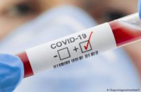 Антирекорд за 4 месяца: в Днепропетровской области увеличивается заболеваемость на COVID-19