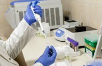 За сутки на Днепропетровщине выявили 72 новых случая коронавируса