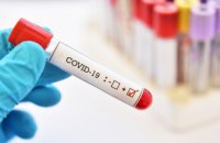 В Украине +7014 новых случаев коронавируса за сутки
