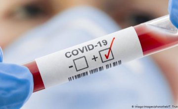 В Украине зафиксировано 794 случая коронавирусной болезни COVID-19