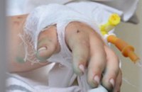 Еще трех пациентов из зоны АТО приняла областная детская больница