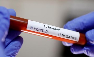 На Днепропетровщине – 6 новых случаев коронавируса