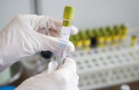 На Днепропетровщине зафиксировали три случая заболевания штаммом коронавируса Delta