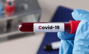 За сутки на Днепропетровщине было обнаружено 237 новых случаев COVID-19