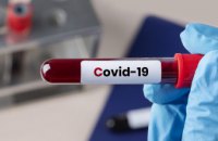 За сутки на Днепропетровщине было обнаружено 237 новых случаев COVID-19