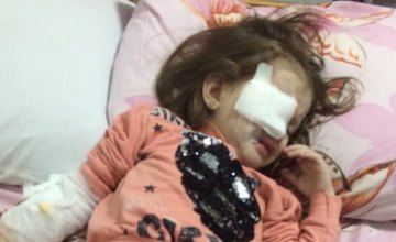 В Днепре в детском садике ребенка ударили карандашом в глаз (ВИДЕО)