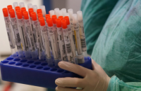 За сутки в Днепропетровской области обнаружили 856 новых случаев коронавируса