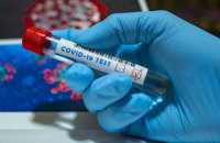 За сутки в Днепропетровской области выявили 34 новых случая коронавируса