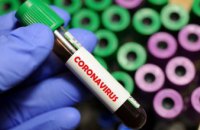 В Украине зафиксировано 2777 случаев коронавирусной болезни COVID-19