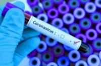 За сутки ещё 10 282 украинца заболели коронавирусом