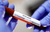 За добу на Дніпропетровщині виявили 64 випадки коронавірусу 