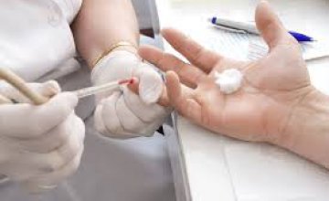 Сегодня жители Днепра могут бесплатно провериться на гепатит С