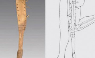 В Китае обнаружен мужчина с 2200-летним протезом